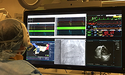 Image: Cardiac electrophysiologist John N. Catanzaro, MD, performs a convergent ablation to treat atrial fibrillation.